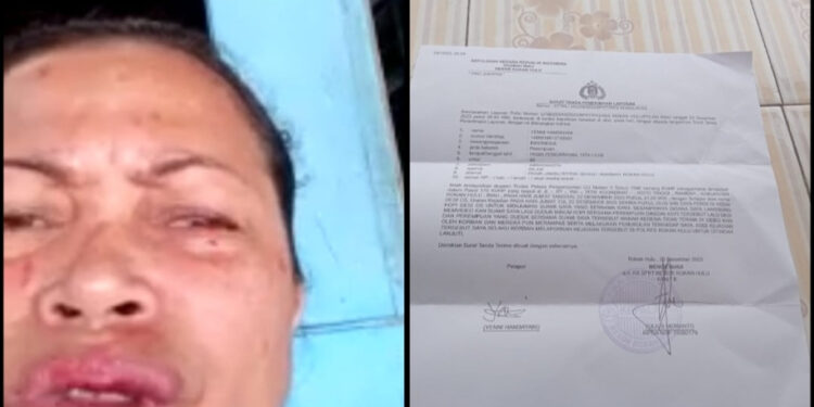 Diduga Lakukan Pengeroyokan, Yeni Minta Pelaku Segera Ditangkap