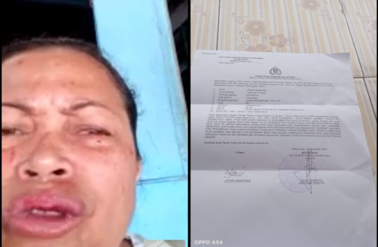 Diduga Lakukan Pengeroyokan, Yeni Minta Pelaku Segera Ditangkap
