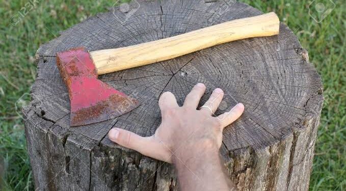 Tangan Kepala Desa di Gayo Putus, Dibacok Seorang Pria  