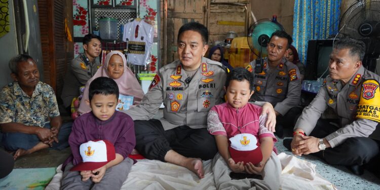 Dibiayai Jenderal Bintang 2, Adik-Kakak Penderita Tulang Kaca di Pekanbaru Berangsur Pulih