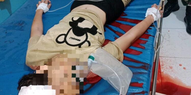 Tak Sengaja” Pelajar 12 Tahun Tewas Tertembak Senjata Airgun