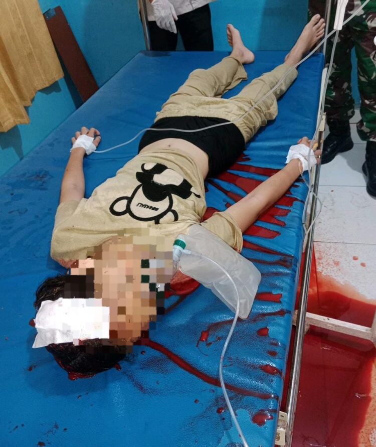 Tak Sengaja” Pelajar 12 Tahun Tewas Tertembak Senjata Airgun