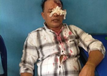 Diduga Aparat Terlibat, Nasabah Di Keroyok Debt Collektor Aniaya Korban Hingga Berdarah