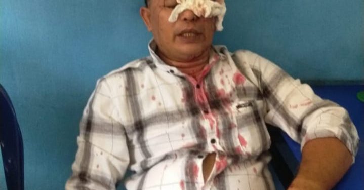 Diduga Aparat Terlibat, Nasabah Di Keroyok Debt Collektor Aniaya Korban Hingga Berdarah